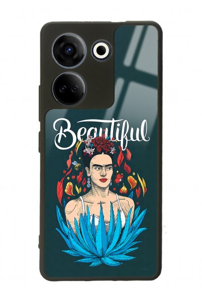 Camon 20 4G Beautiful Frida Kahlo Tasarımlı Glossy Telefon Kılıfı