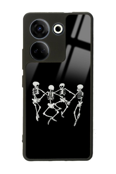 Camon 20 4G Dancer Skeleton Tasarımlı Glossy Telefon Kılıfı